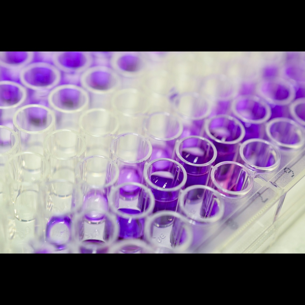 Porcine Creatine Kinase Msize:type, CKM ELISA Kit, 96 test